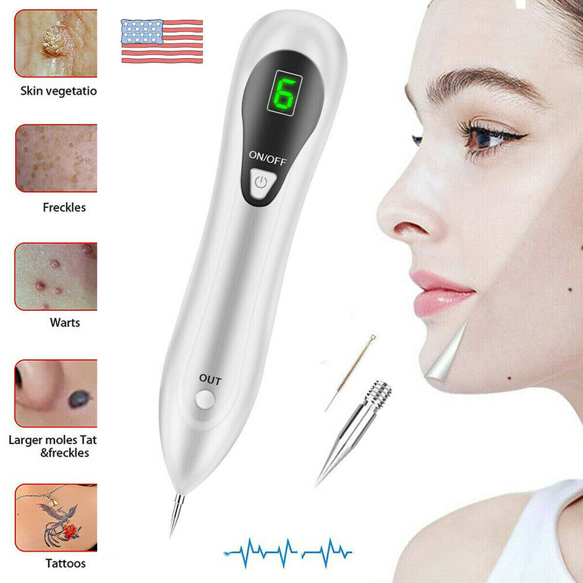 Electric Laser Plasma Pen Mole Removal Dark Spot Remover Skin Wart Tag